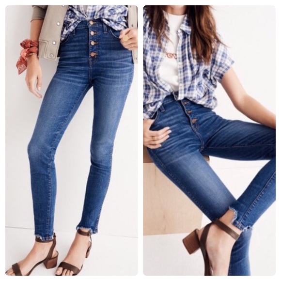 Madewell Denim - Madewell 10” High Rise Skinny Button Jeans